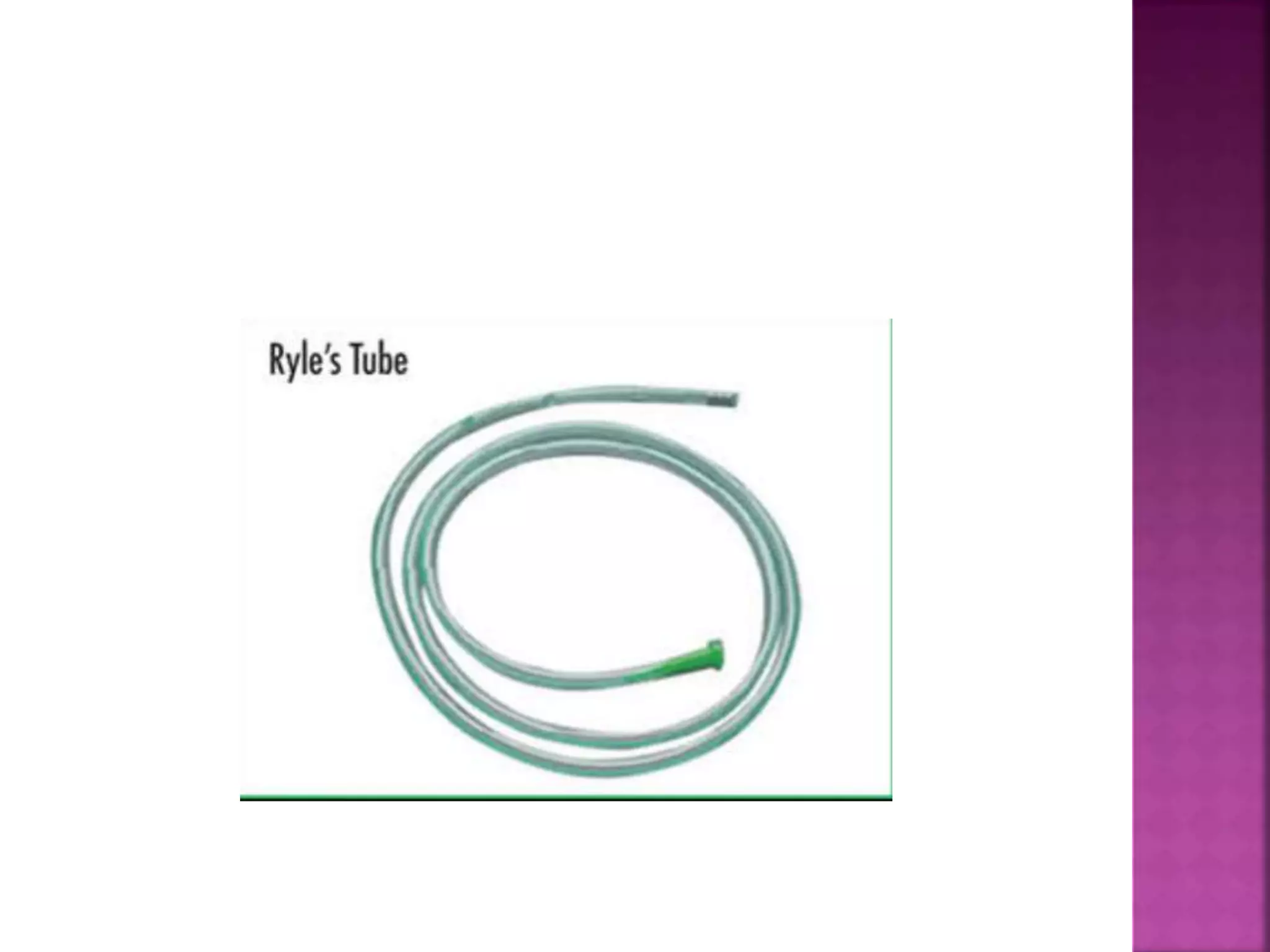 Ryles tube | PPTX