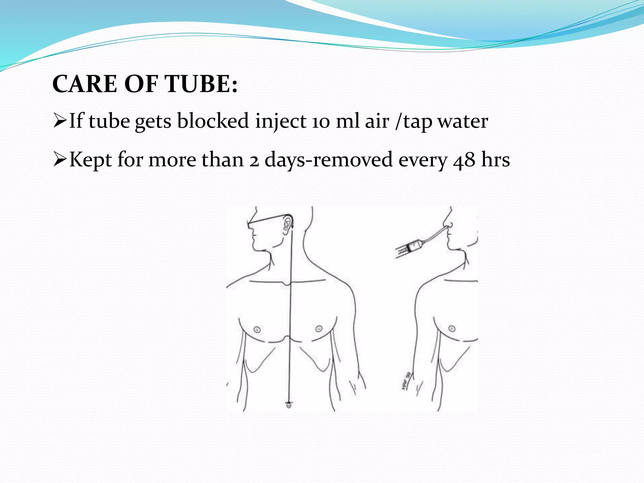 CARE OF TUBE:
If tube gets blocked inject 10 ml air /tap water
Kept for more than 2 days-removed every 48 hrs
 