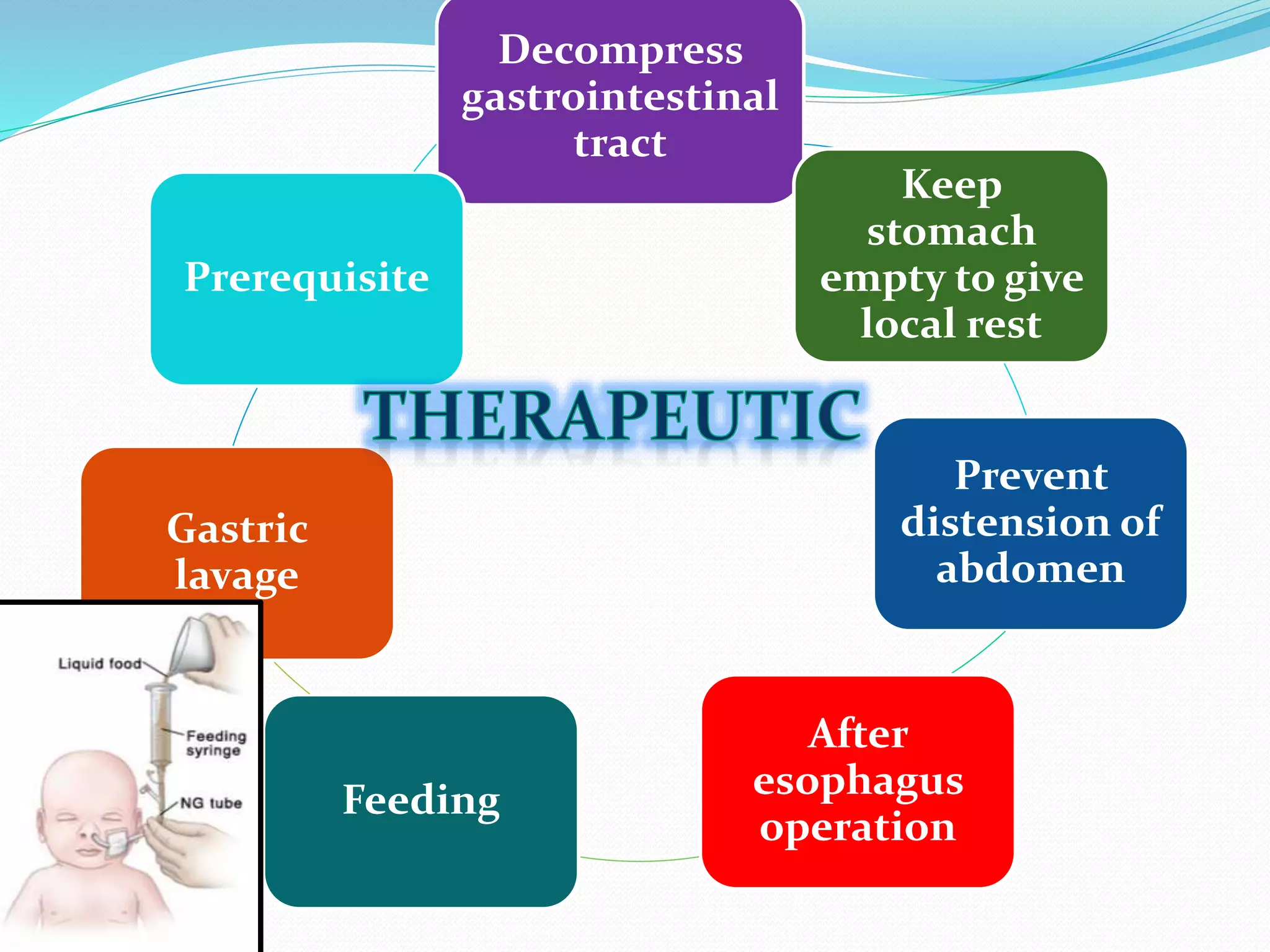 Decompress
gastrointestinal
tract
Keep
stomach
empty to give
local rest
Prevent
distension of
abdomen
After
esophagus
operation
Feeding
Gastric
lavage
Prerequisite
 