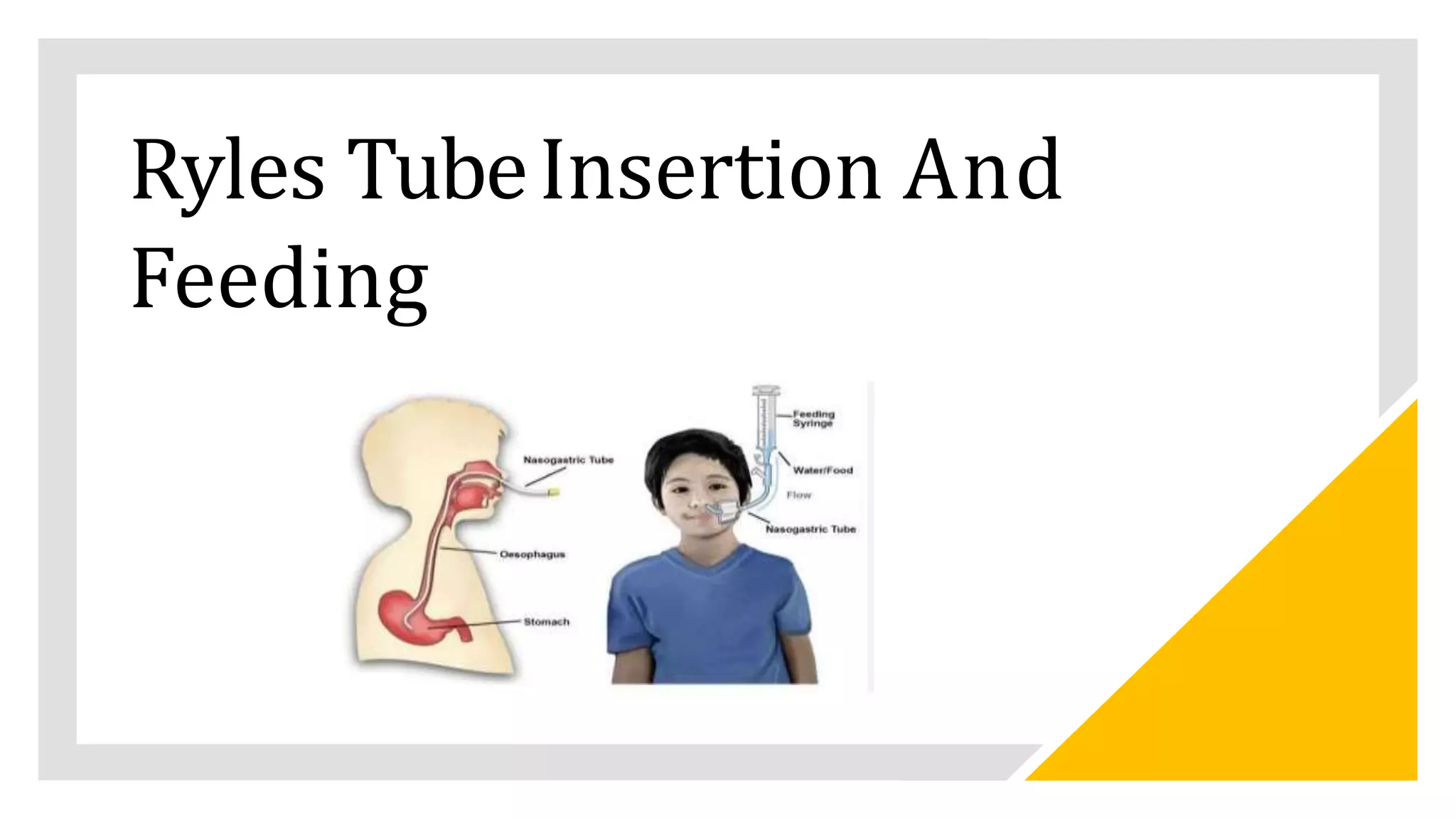 ryles tube insertion and feeding PPT