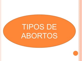 TIPOS DE 
ABORTOS 
 