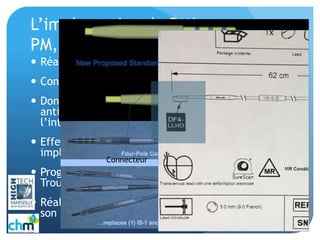L’implantation de DMI
PM, DEF, HI
 Réaliser l’antibioprophylaxie
 Connaître le matériel
 Donner le matériel stérile pour l’implantation,
anticiper le matériel en fonction des étapes de
l’intervention
 Effectuer les mesures et les tests des sondes
implantées
 Programmer les DMI avec le médecin, Induire des
Troubles du rythme..
 Réaliser Pansement, et transférer le patient dans
son service
Connecteur
 