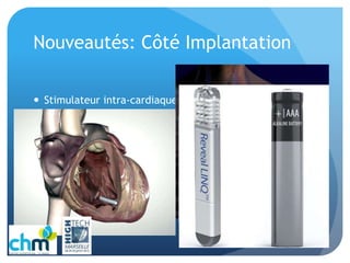 Nouveautés: Côté Implantation
 Stimulateur intra-cardiaque
 Défibrillateur sous-cutané
 Holter implantable
 