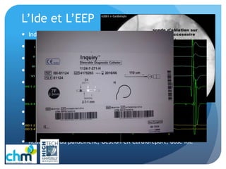 L’Ide et L’EEP
 Indication de l’examen?
 Quelles sondes d'exploration?
 Taille introducteur au regard des sondes
 Branchements sur le Boîtier de connexion de la baie
 Sondes positionnées par le médecin sous scopie dans les
différentes cavités (OD, SC, VD, OG, V pulm, VG…)
 Réalisation de différents protocoles, prises de mesures
 Connaissance de la Baie d’EEP (Stimulateur, Trigger, Caliper…)
 Injection de Médicament:(Atropine, Isuprel, Flécaine,
Ajmaline…)
 Réalisation du pansement, Gestion CR Cardioreport, dose RX.
 