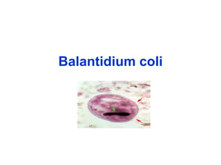 Balantidium coli 
 