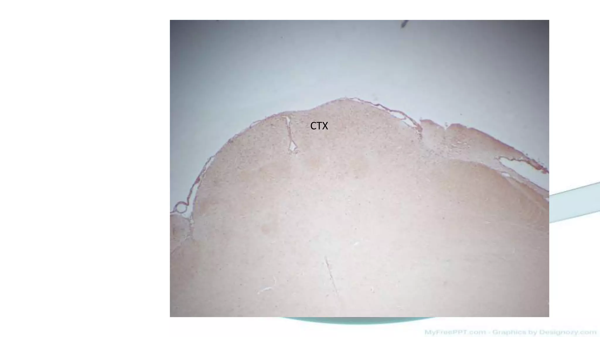 Mouse brain immunohistochemistry staining | PPT