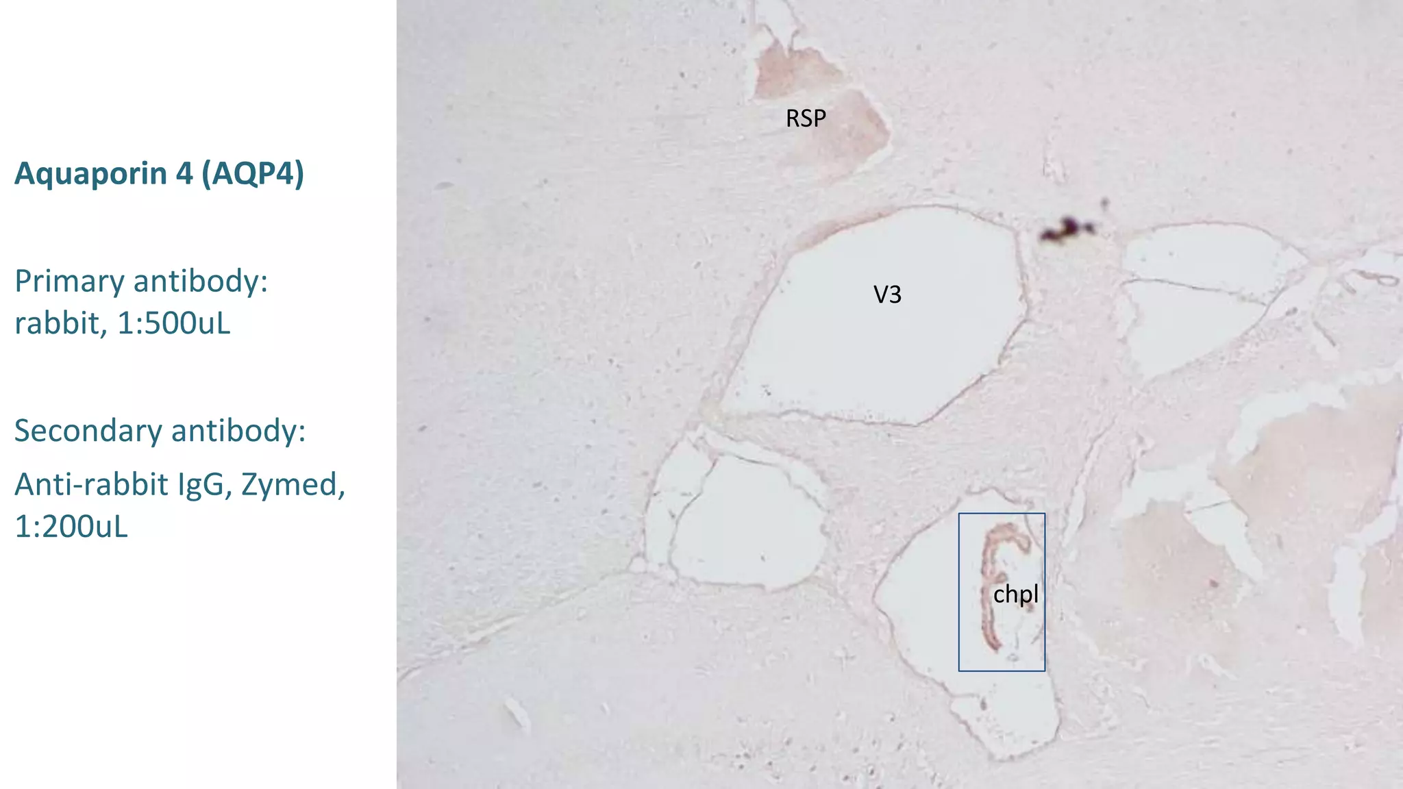 Mouse brain immunohistochemistry staining | PPT