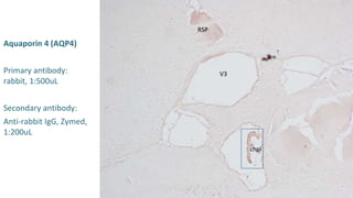 Aquaporin 4 (AQP4)
Primary antibody:
rabbit, 1:500uL
Secondary antibody:
Anti-rabbit IgG, Zymed,
1:200uL
chpl
V3
RSP
 