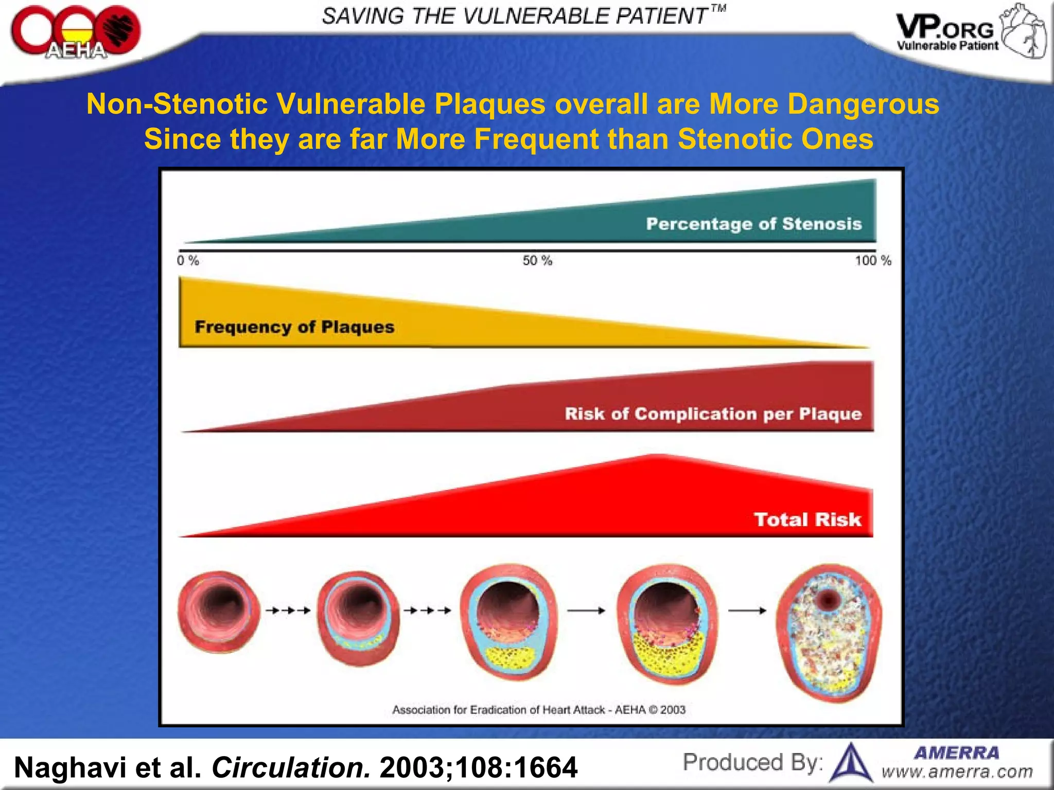 Naghavi et al. Circulation. 2003;108:1664
Non-Stenotic Vulnerable Plaques overall are More Dangerous
Since they are far More Frequent than Stenotic Ones
 