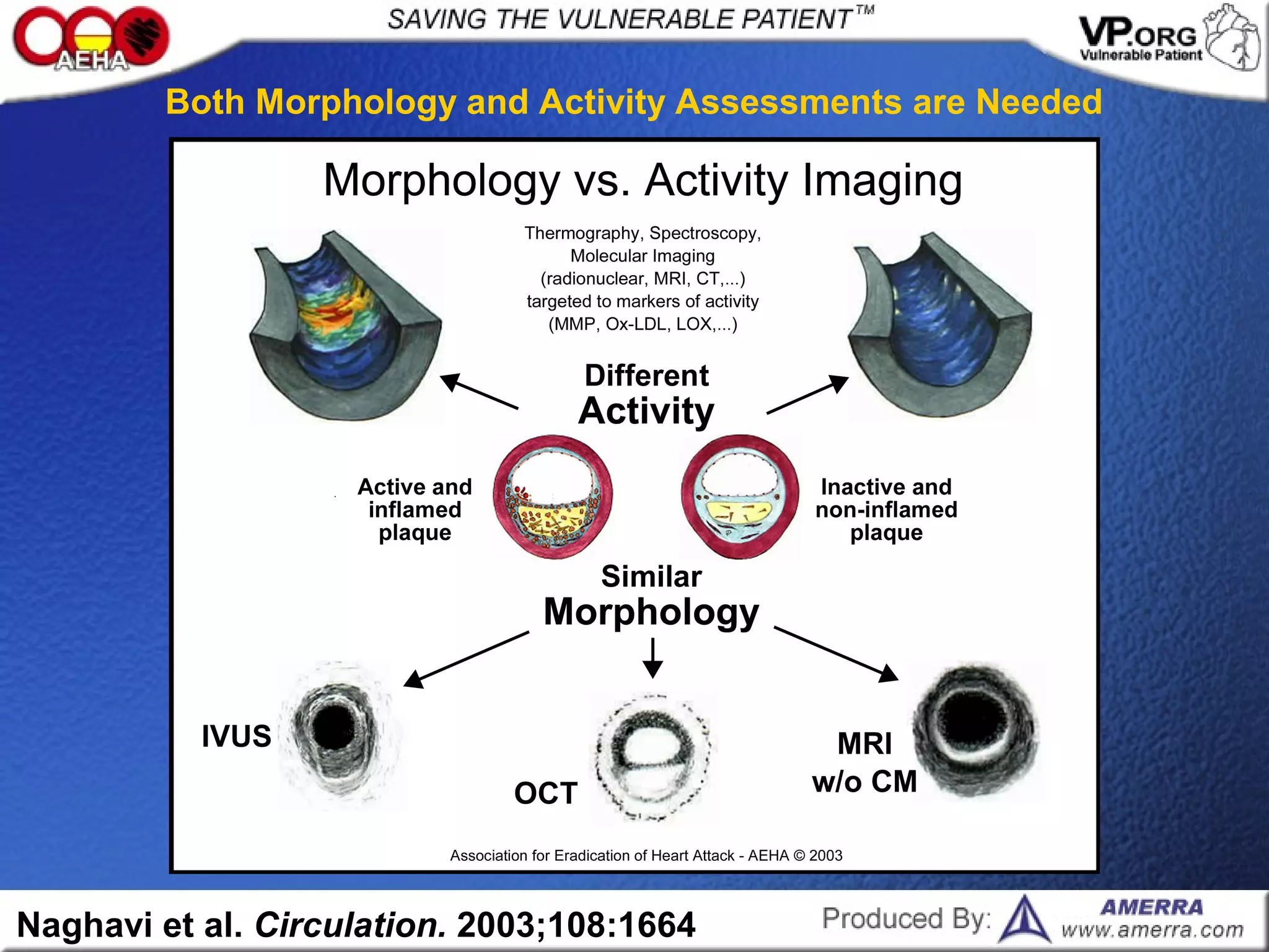 Naghavi et al. Circulation. 2003;108:1664
Both Morphology and Activity Assessments are Needed
 