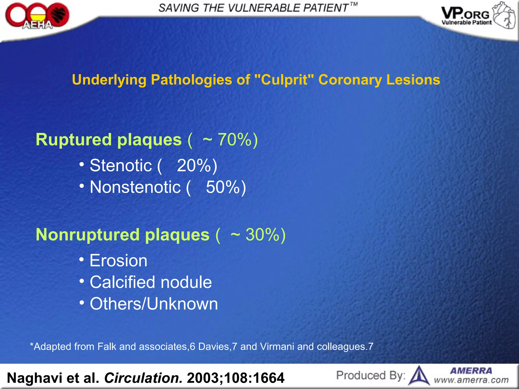 Underlying Pathologies of "Culprit" Coronary Lesions
Naghavi et al. Circulation. 2003;108:1664
Ruptured plaques ( ~ 70%)
• Stenotic ( 20%)
• Nonstenotic ( 50%)
Nonruptured plaques ( ~ 30%)
• Erosion
• Calcified nodule
• Others/Unknown
*Adapted from Falk and associates,6 Davies,7 and Virmani and colleagues.7
 