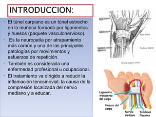











El túnel carpiano es un túnel estrecho
en la muñeca formado por ligamentos
y huesos (paquete vasculone...