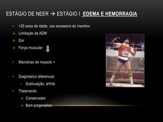 ESTÁGIO DE NEER  ESTÁGIO I EDEMA E HEMORRAGIA
• <25 anos de idade, uso excessivo do membro
 Limitação de ADM
 Dor
 Força muscular
• Manobras de impacto +
• Diagnóstico diferencial:
- Subluxação, artrite
• Tratamento:
 Conservador
 Bom prognostico
 