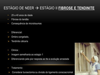 ESTÁGIO DE NEER  ESTÁGIO II FIBROSE E TENDINITE
• 25 a 40 anos de idade
• Fibrose do tendão
• Consequência de microtraumas
• Diferencial:
 Ombro congelado,
 Tendinite cálcaria
• Clinica :
 Imagem semelhanta ao estagio 1
 Diferenciando pela pior resposta ao tto e evolução arrastada
• Tratamento:
 Considerar bursectomia ou divisão do ligamento coracoacromial
 