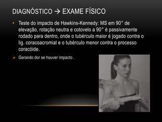 DIAGNÓSTICO  EXAME FÍSICO
• Teste do impacto de Hawkins-Kennedy: MS em 90° de
elevação, rotação neutra e cotovelo a 90° é passivamente
rodado para dentro, onde o tubérculo maior é jogado contra o
lig. coracoacromial e o tubérculo menor contra o processo
coracóide.
 Gerando dor se houver impacto .
 