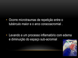 • Ocorre microtraumas de repetição entre o
tubérculo maior e o arco coracoacromial .
• Levando a um processo inflamatório com edema
e diminuição do espaço sub-acromial .
 