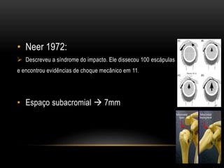 • Neer 1972:
 Descreveu a síndrome do impacto. Ele dissecou 100 escápulas
e encontrou evidências de choque mecânico em 11.
• Espaço subacromial  7mm
 