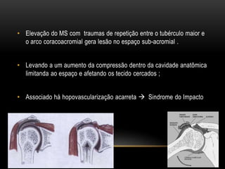 • Elevação do MS com traumas de repetição entre o tubérculo maior e
o arco coracoacromial gera lesão no espaço sub-acromial .
• Levando a um aumento da compressão dentro da cavidade anatômica
limitanda ao espaço e afetando os tecido cercados ;
• Associado há hopovascularização acarreta  Sindrome do Impacto
 