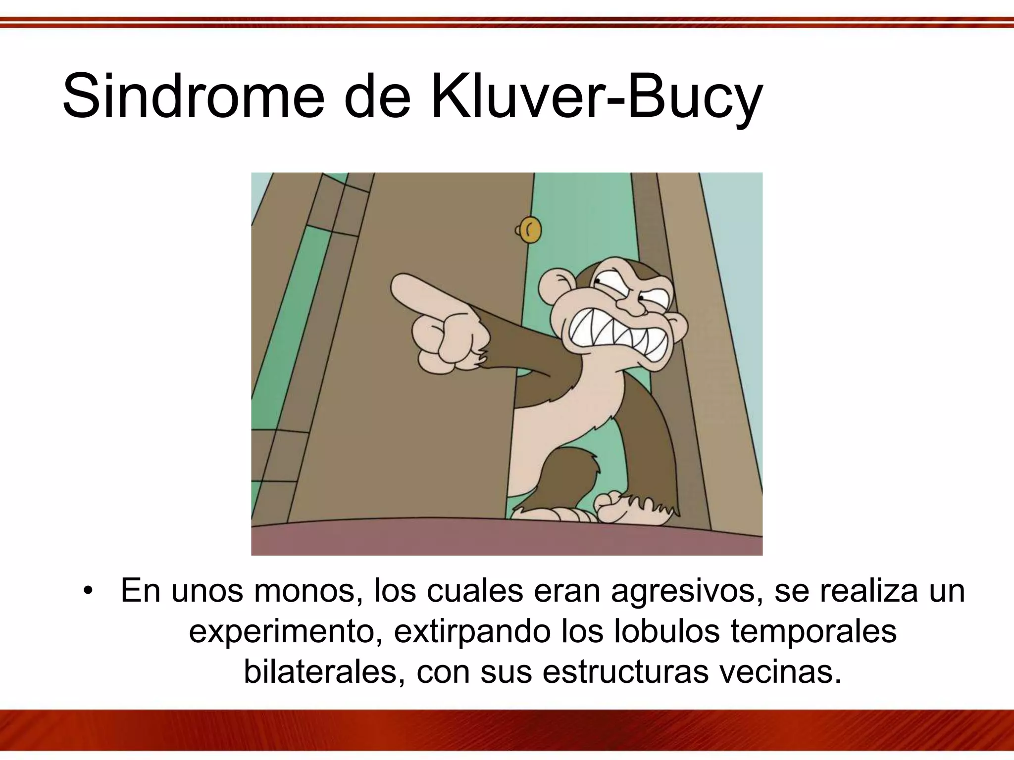 Sindrome de Kluver-Bucy
• En unos monos, los cuales eran agresivos, se realiza un
experimento, extirpando los lobulos temporales
bilaterales, con sus estructuras vecinas.
 