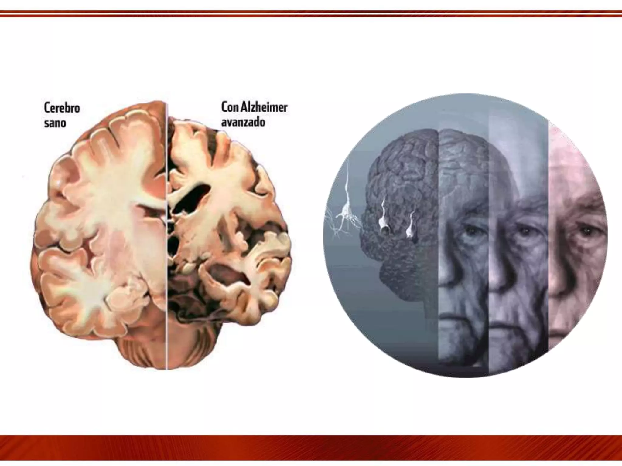 Sistema limbico .limbico