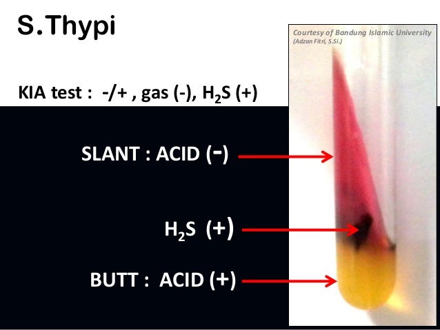 KIA Salmonella typhi (UNISBA - Indonesia)
