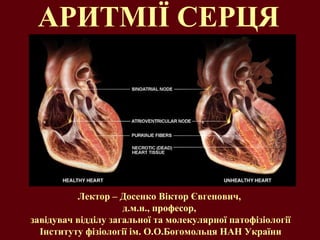 АРИТМІЇ СЕРЦЯ
Лектор – Досенко Віктор Євгенович,
д.м.н., професор,
завідувач відділу загальної та молекулярної патофізіології
Інституту фізіології ім. О.О.Богомольця НАН України
 