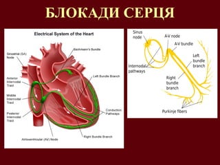 БЛОКАДИ СЕРЦЯ
 