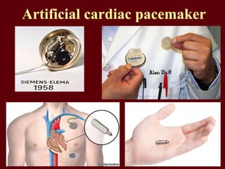 Artificial cardiac pacemaker
 