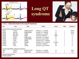 Long QT
syndrome
 