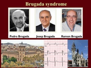 Brugada syndrome
 