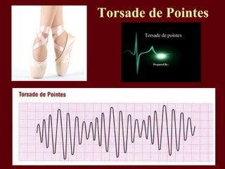 Torsade de Pointes
 
