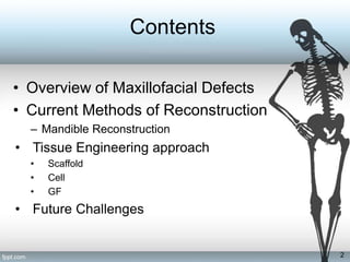Bone tissue engineering challenges in oral and maxillofacial surgery | PPTX