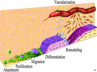 Bone tissue engineering challenges in oral and maxillofacial surgery | PPTX