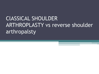 ClASSICAL SHOULDER
ARTHROPLASTY vs reverse shoulder
arthropalsty
 