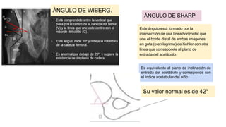DISPLASIA CONGENITA DE CADERA.pdf