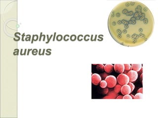 Staphylococcus
aureus
 
