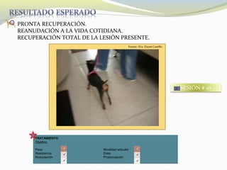 TRATAMIENTO
Objetivo
Peso Movilidad articular
Resistencia Dolor
Musculación Propiocepción
PRONTA RECUPERACIÓN.
REANUDACIÓN A LA VIDA COTIDIANA.
RECUPERACIÓN TOTAL DE LA LESIÓN PRESENTE.






SESIÓN # 10
Fuente: Dra. Dayssi Castillo
 