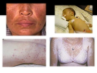 Examen a “ojo desnudo” y con ayuda de lupa.