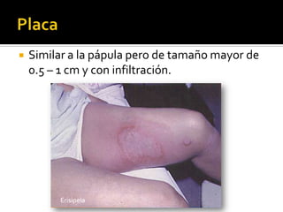 Inspección: Topografía de las lesiones, distribución, formas, tamaño, bordes, contornos, límites, superficie, color y el aspecto [polimorfo, monomorfo, pseudopolimorfo]