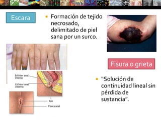 GomasUna variedad de nódulosEvolución CrudezaReblandecimientoUlceración/evacuaciónReparación cicatrizalEscrofulodermia
