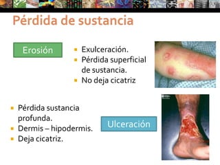 TumorNeoformación no inflamatoriaTamaño variableSólida o de contenido líquidoSuperficial o profundaTendencia a persistir y crecer indefinidamente