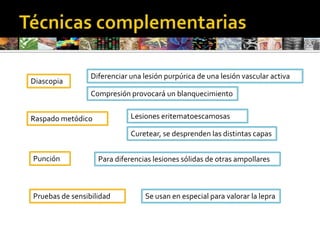 AmpollaCavidad de contenido líquido> 5 mmMecanismos de formaciónDespegamiento superficial. Ej: ImpétigoDespegamiento profundo. Ej: Dermatitis herpetiformeAcantólisis: Pérdida de las uniones intercelulares. Ej: Pénfigo