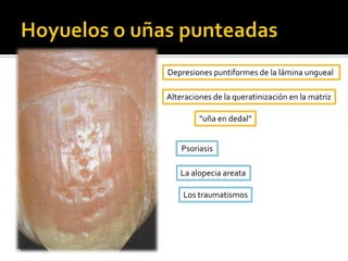 Dermis – hipodermis.