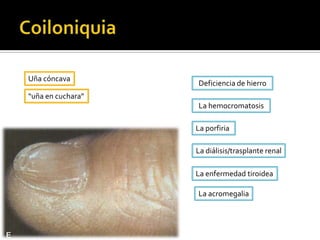 Deja cicatriz.Ulceración