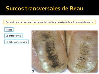 Producida por el paciente.