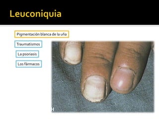 Instrumental o traumática.Excoriación