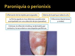 Se arruga con facilidad.AtrofiaEsclerosisInduración de la piel.