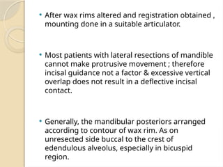 Registration Rims Comprehensive Classification and Prosthetic Treatment of Mandibular ...
