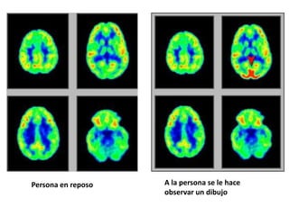 Persona en reposo   A la persona se le hace
                    observar un dibujo
 