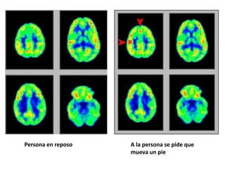 Persona en reposo   A la persona se pide que
                    mueva un pie
 